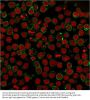 Anti-CD22 / BL-CAM Monoclonal Antibody