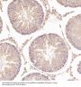 Anti-N-Cadherin-2 CDH2 CD325-Rabbit Monoclonal Antibody