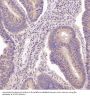 Anti-N-Cadherin-2 CDH2 CD325-Rabbit Monoclonal Antibody