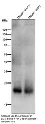 Anti-SOCS2 Rabbit Monoclonal Antibody