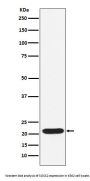 Anti-SOCS2 Rabbit Monoclonal Antibody
