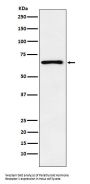 Anti-Parathyroid Hormone Receptor 1 Monoclonal Antibody