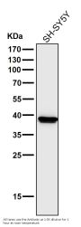 Anti-Cathepsin L/V/K/H Rabbit Monoclonal Antibody