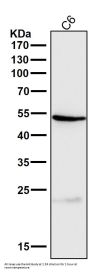 Anti-Cathepsin L/V/K/H Rabbit Monoclonal Antibody