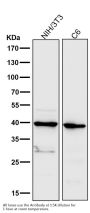 Anti-Cathepsin L/V/K/H Rabbit Monoclonal Antibody