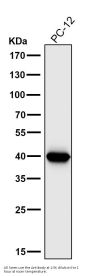 Anti-Cathepsin L/V/K/H Rabbit Monoclonal Antibody