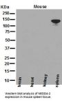 Anti-NEDD4-2 NEDD4L Rabbit Monoclonal Antibody