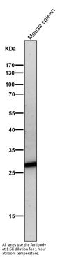 Anti-Neutrophil Elastase ELANE Rabbit Monoclonal Antibody