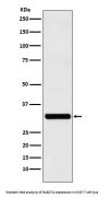 Anti-RAB27A Rabbit Monoclonal Antibody
