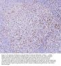 Anti-RAB27A Antibody Picoband® (monoclonal, 2F5)