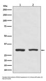 Anti-Bcl10 Rabbit Monoclonal Antibody