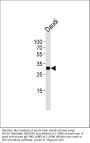 Anti-BCL10 Antibody