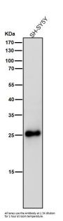Anti-SNAP25 Rabbit Monoclonal Antibody