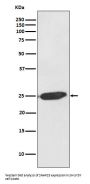 Anti-SNAP25 Rabbit Monoclonal Antibody