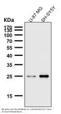 Anti-SNAP25 Rabbit Monoclonal Antibody