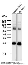 Anti-SNAP25 Rabbit Monoclonal Antibody