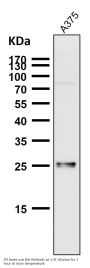 Anti-SNAP25 Rabbit Monoclonal Antibody