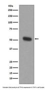 Anti-TPH1/Tph Rabbit Monoclonal Antibody
