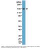 Anti-CD21 CR2 Rabbit Monoclonal Antibody, Clone#RM372