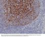 Anti-CD21 CR2 Rabbit Monoclonal Antibody, Clone#RM372