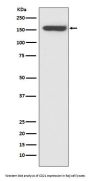 Anti-CD21 CR2 Rabbit Monoclonal Antibody