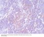 Anti-CD21 CR2 Rabbit Monoclonal Antibody