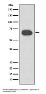 Anti-Cytokeratin 1 Rabbit Monoclonal Antibody