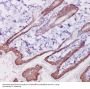 Anti-Cytokeratin 1 Rabbit Monoclonal Antibody