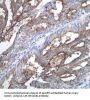Anti-CA125 / MUC16 Monoclonal Antibody