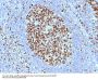 Anti-MCM7 / CDC47 (Proliferation Marker) Monoclonal Antibody