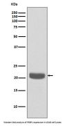 Anti-PEBP1/Pbp Rabbit Monoclonal Antibody