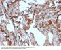 Anti-MUC18 / CD146 / MCAM (Melanoma Cell Adhesion Molecule) Monoclonal Antibody