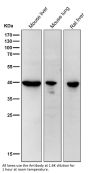 Anti-67kDa Laminin Receptor RPSA Rabbit Monoclonal Antibody