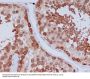 Anti-Hsp90 beta HSP90AB1 Rabbit Monoclonal Antibody