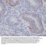 Anti-Integrin alpha 6 ITGA6 Rabbit Monoclonal Antibody