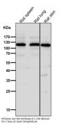 Anti-Integrin alpha 6 ITGA6 Rabbit Monoclonal Antibody