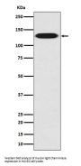 Anti-Myosin light chain kinase MYLK Rabbit Monoclonal Antibody