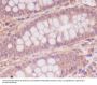 Anti-Myosin light chain kinase MYLK Rabbit Monoclonal Antibody