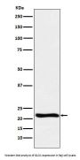 Anti-GLO1 Monoclonal Antibody
