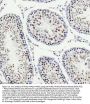 Anti-PIAS1+PIAS2+PIAS3 Rabbit Monoclonal Antibody