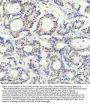 Anti-PIAS1+PIAS2+PIAS3 Rabbit Monoclonal Antibody