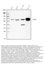 Anti-Liver Carboxylesterase 1/CES1 Antibody Picoband® (monoclonal, 3F10)