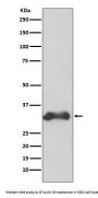Anti-Cyclin D3 CCND3 Rabbit Monoclonal Antibody