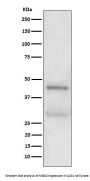 Anti-MBD2 Rabbit Monoclonal Antibody