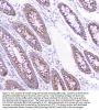 Anti-CD2AP Antibody Picoband® (monoclonal, 5F8)