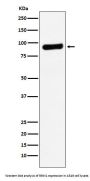 Anti-RRM1 Monoclonal Antibody