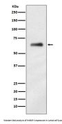 Anti-hnRNP K Rabbit Monoclonal Antibody