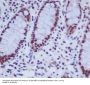 Anti-hnRNP K Rabbit Monoclonal Antibody