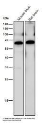 Anti-hnRNP K Rabbit Monoclonal Antibody