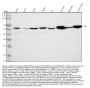 Anti-ATGL / PNPLA2 Rabbit Monoclonal Antibody